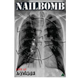 Live At Dynamo Open Air Nailbomb