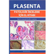 Plasenta Patolojik inceleme iin El Kitab Esin Kotilolu Karaa Palme Yaynclk