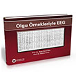 Olgu rnekleriyle EEG Gne Tp